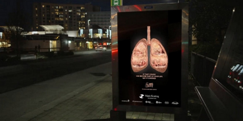 Wyjątkowy  billboard zwraca uwagę na profilaktykę nowotworów płuc